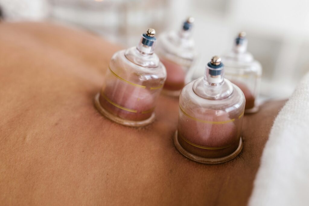 pexels-photo-8312830-8312830 Detailed image of cupping therapy on a person's back, showcasing alternative medicine practice.